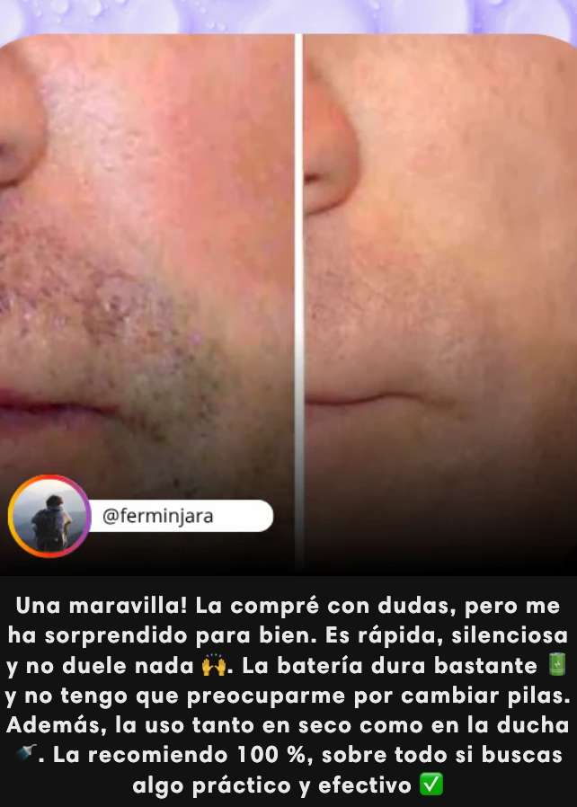 Depiladora Portátil Velvet Pro