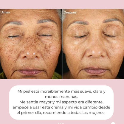 ¡10 Años Menos! Dragon's Blood