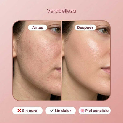 Piel Impecable en Segundos –LipSmooth™