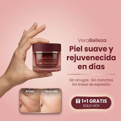 Dragon Cream VeraBelleza™ - Rejuvenece y suaviza tu piel en menos de 10 días