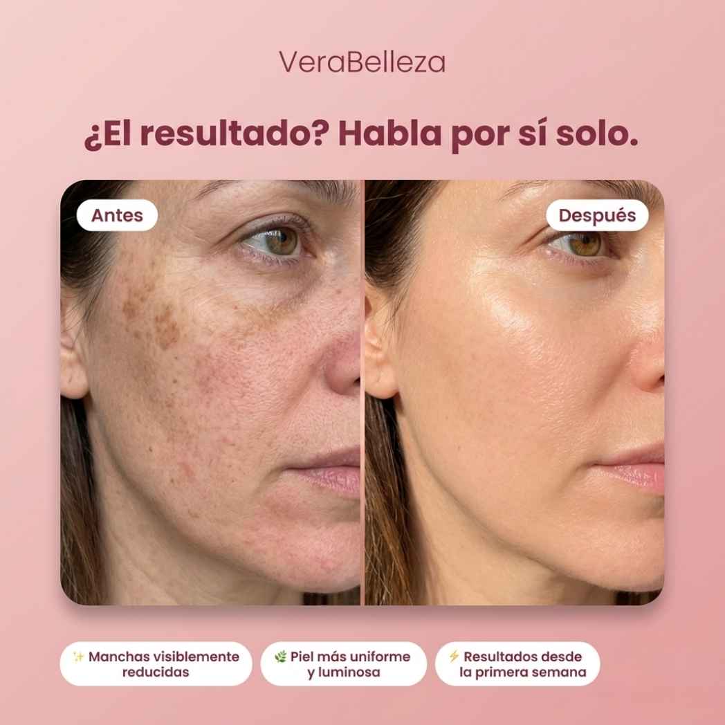 Dragon Cream VeraBelleza™ - Rejuvenece y suaviza tu piel en menos de 10 días
