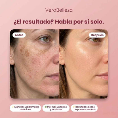 Dragon Cream VeraBelleza™ - Rejuvenece y suaviza tu piel en menos de 10 días